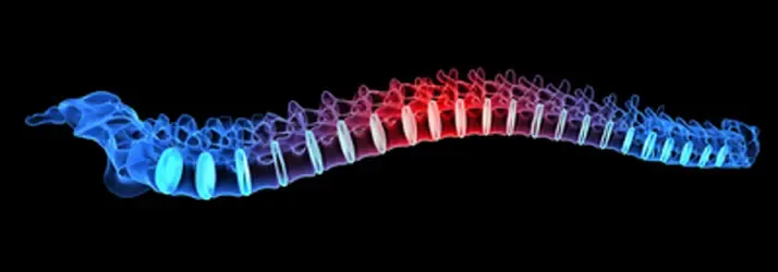 Illustration of a spine on a black background with vertebrae highlighted in blue and red along the curved structure.